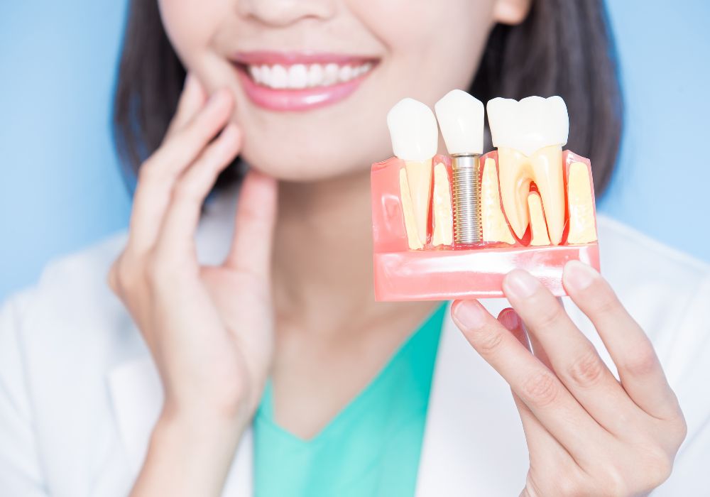 Implantes dentales: qué son, cuándo se recomiendan y cómo es el tratamiento